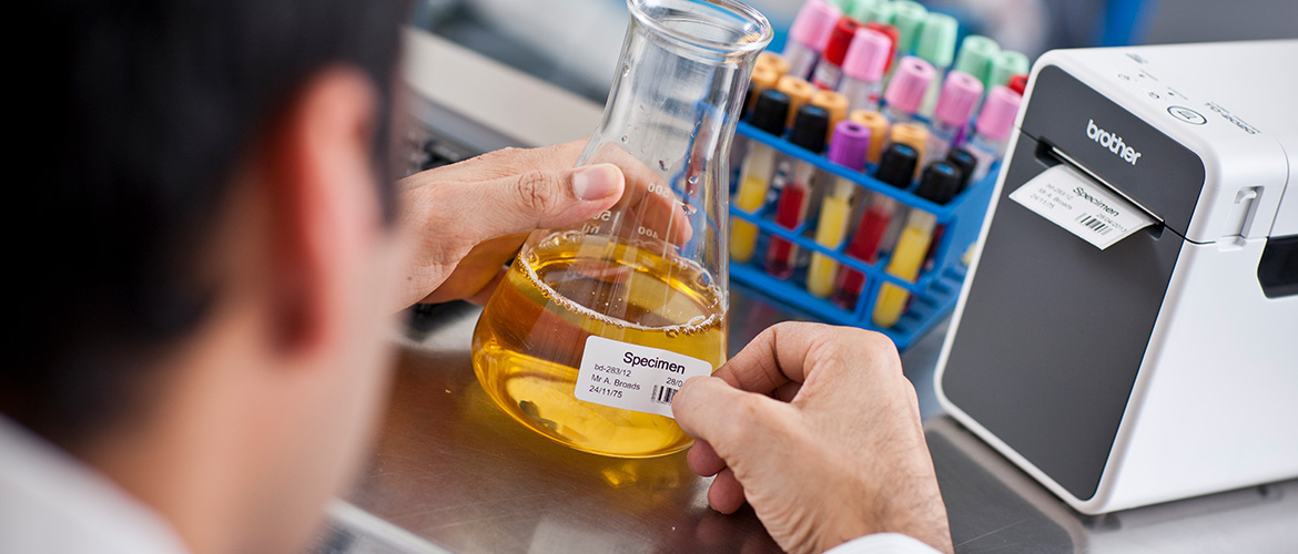 LABORMITAGEBERBEIDERSCHRIFTET EINE PRODE MIT EIEM Barcodeetikett aus dem EtikettendRucker.